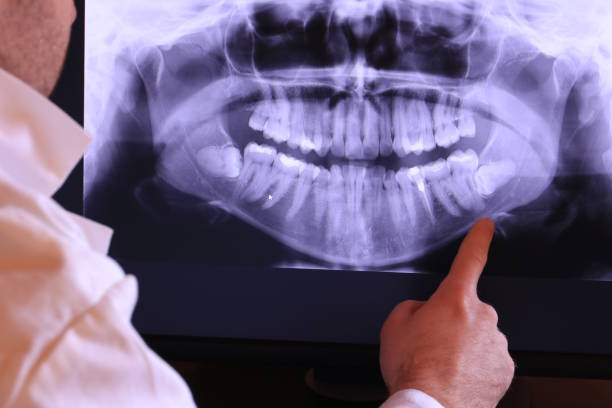 Best Emergency Dental Extractions in Virginia, IL