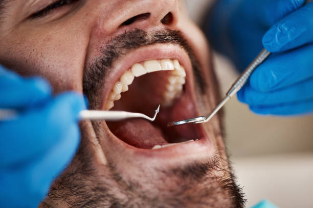 Best Pediatric Emergency Dentist in Virginia, IL